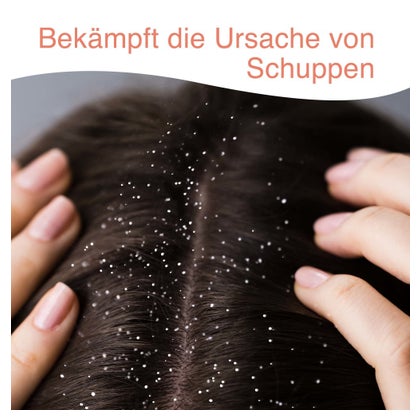 https://statics.docmorris.de/static/produkte/FX58IS17/docmorris/ps420/stieprox-intensiv-shampoo-100-ml-00085077-7-1713966494523889.jpeg