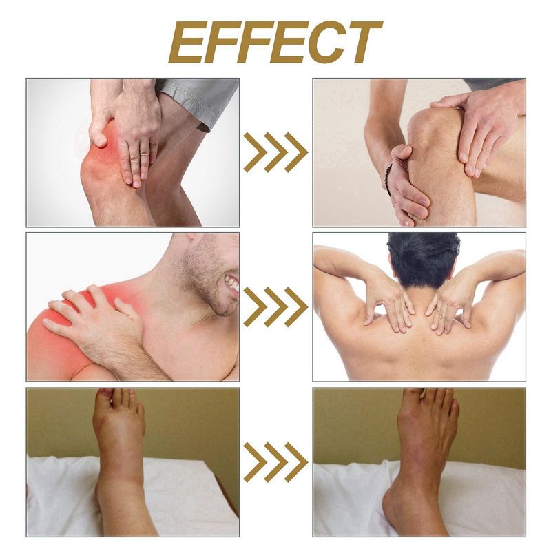 Bee Venom Joint Pain Relief Cream for Knee and Neck