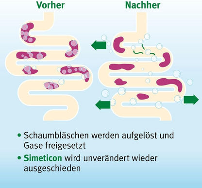 Espumisan Emulsion bei Blähungen, 30 ml Lösung