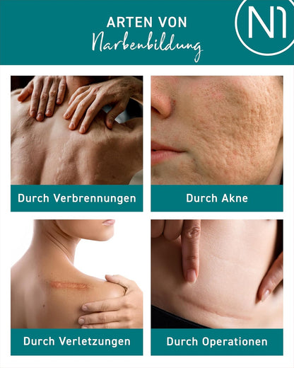 N1 Narbensalbe 19 g - Narbengel und Narbencreme aus der Apotheke